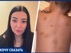 Кусали дети, но виноваты взрослые: мама травмированного в детсаду ребенка обратилась к губернатору Ставрополья