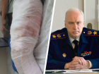 Бастрыкин потребовал возбудить дело после нападения собаки на ребенка в Ставропольском крае