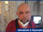 Водителя скорой помощи в Невинномысске избили после конфликта с диспетчером