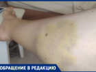 Ужасная боль и шок: беременная ставропольчанка рассказала о ДТП без виновных