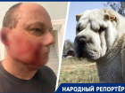 «Я прижался к калитке и стал стучать»: собака напала на ставропольца и покусала лицо