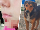 «Прохожие никак не отреагировали»: собака напала на 10-летнюю девочку в военном городке Ставрополя 