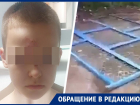 «Весь в крови был»: 10-летнего ребенка в Ставрополе придавило ограждением детской площадки 