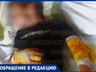 «Руки прокусаны насквозь»: после нападения агрессивного ротвейлера ребенок попал в больницу на Ставрополье
