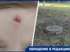 «Пришлось накладывать швы»: территория сельского детсада на Ставрополье стала угрозой для детей 