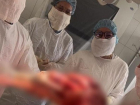 Ставропольские врачи удалили у пациентки гигантскую опухоль весом 17 килограммов 