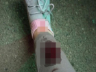 Девушка разбила ногу и провалилась в плохо установленный люк в Ставрополе 
