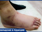 «Нога была черная и раздувалась все больше»: мама обвинила руководство школы в бессердечности на Ставрополье