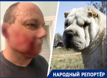 «Я прижался к калитке и стал стучать»: собака напала на ставропольца и покусала лицо
