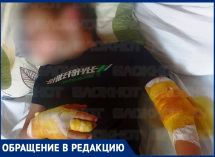 «Руки прокусаны насквозь»: после нападения агрессивного ротвейлера ребенок попал в больницу на Ставрополье