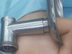 Рука двухлетнего малыша застряла в мясорубке