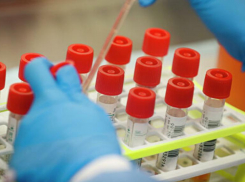 В России зарегистрировали первый экспресс-тест на коронавирус