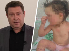 Родители скончавшейся от менингита 4-летней девочки получили соболезнования от главы минздрава Ставрополья 