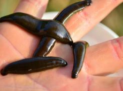 На Ставрополье полиция проверяет деятельность пиявочного «дилера»