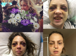 Житель Ессентуков, избивший московскую журналистку, по-прежнему находится на свободе