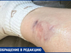 Собаки накинулись и покусали женщину в парке Минераловодского округа