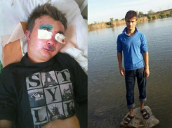 На Ставрополье парень впал в кому после массового избиения