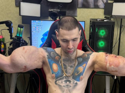 Инсульт после операции заподозрил у себя ставропольский фрик-блогер Руки Базуки: ему еще тяжело говорить 