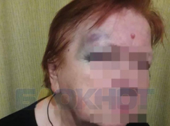 Полиция разбирается в деле об избиении пенсионерки таксистом в Ставрополе