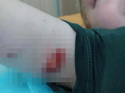 Агрессивная собака покусала пятилетнего ребенка на детской площадке в Михайловске