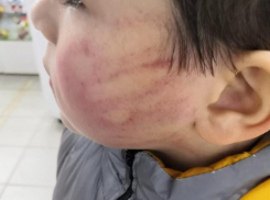 Избившая ребенка воспитательница из Георгиевска неоднократно распускала руки 