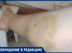 Ужасная боль и шок: беременная ставропольчанка рассказала о ДТП без виновных