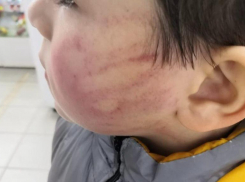 Воспитательница детского сада в Георгиевске избила ребенка за непослушание