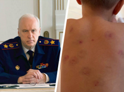 Бастрыкин запросил доклад после травмирования ребенка в детсаду Минеральных Вод