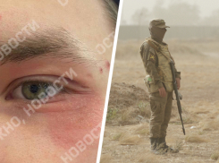 «Тут и с болезнями похуже служат»: в военную часть под Ставрополем попал парень с тяжелым дерматитом