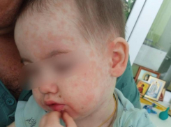 После публикации «Блокнота Ставрополь» прокуратура начала проверку качества лечения ребенка