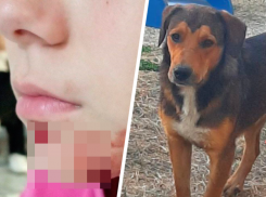 «Прохожие никак не отреагировали»: собака напала на 10-летнюю девочку в военном городке Ставрополя 