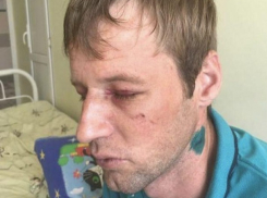 Молодую семью зверски избили из-за замечания не кричать ночью под окнами в Ставрополе 