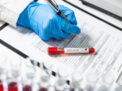 Коронавирус за прошедшие сутки подтвердился у 102 ставропольцев