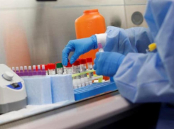 Еще 80 ставропольцев заразились коронавирусом