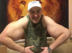 После откачки яда из тела «Руки-базуки» собирается вернуть себе бицепсы по 60 см