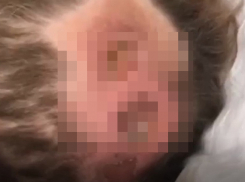 «Она все равно сдохнет»: жительницу Георгиевска вернули из реанимации с пролежнями до кости