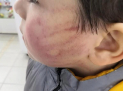 В отношении ударившей ребенка ставропольской воспитательницы возбудили уголовное дело