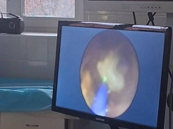 Ребенок мучился от боли, но скальпель не понадобился: врачи в Ессентуках раздробили камень лазером