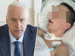 Бастрыкин заинтересовался уголовным делом из-за комы после пластической операции в Пятигорске