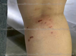 Стая бродячих собак снова напала на ребенка в Минводах