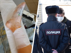 После ДТП с пострадавшей девочкой на Ставрополье полиция начала проверку