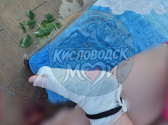 Ребенок получил травму после купания на Старом озере в Кисловодске