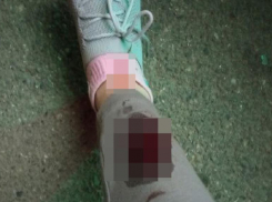 Девушка разбила ногу и провалилась в плохо установленный люк в Ставрополе 