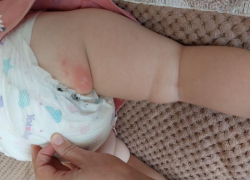 Упавший с балкона на юге Ставрополя окурок обжег ребенка в коляске 