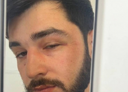 Служебную проверку начали после пыток сотрудниками полиции на Ставрополье