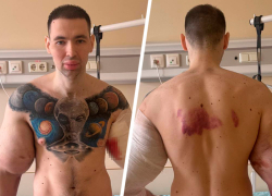 Снявшегося в порно блогера из Пятигорска Руки Базуки экстренно прооперировали: первые кадры