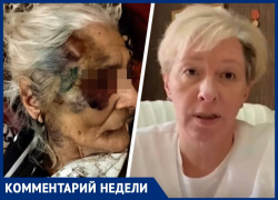 Служебную проверку начали в минздраве Ставрополья после публикации «Блокнота» об избиении пенсионерки