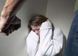 За отказ от знакомства девушке сломали челюсть в Ставрополе