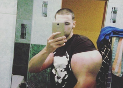 Чудовищно огромные руки за месяц накачал синтолом 21-летний пятигорчанин