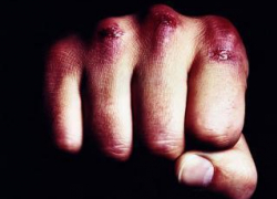 На Ставрополье молодой парень избил до смерти знакомого